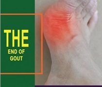End Of Gout Review – Is Shelly Manning’s Guide For You?